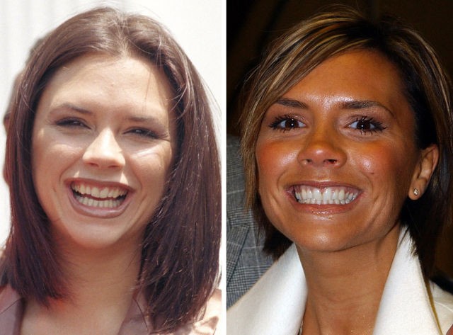 Victoria Beckham