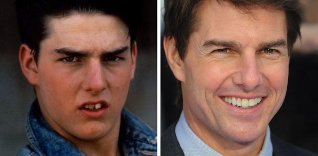 Tom Cruise