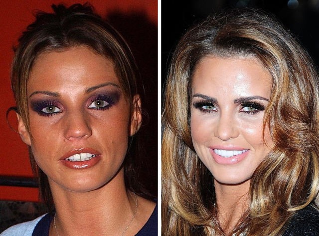 Katie Price